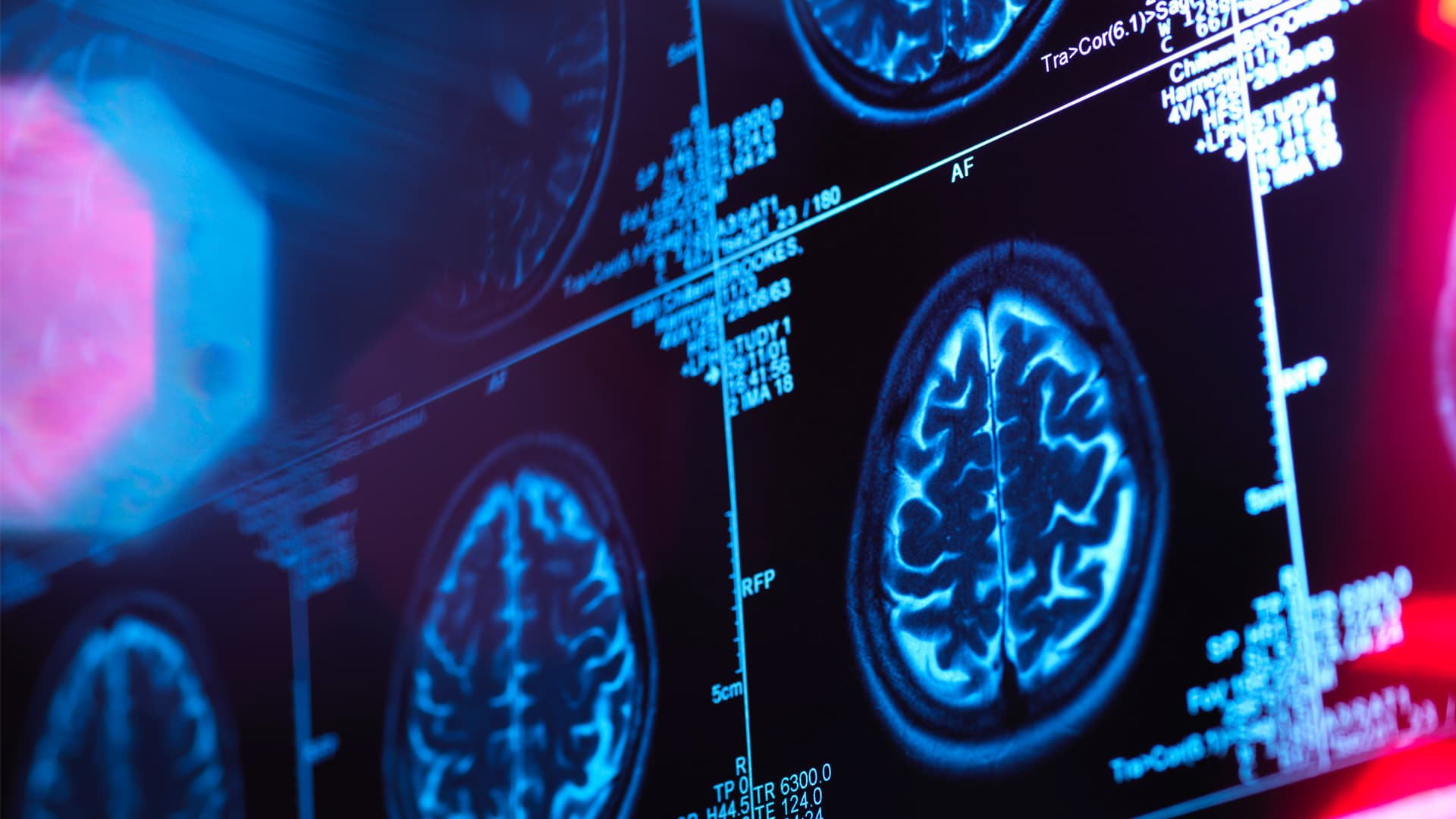 varied-state-level-medicaid-reimbursement-affects-pricing-crowe-llp